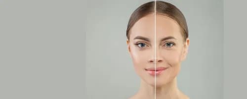 Anti Aging